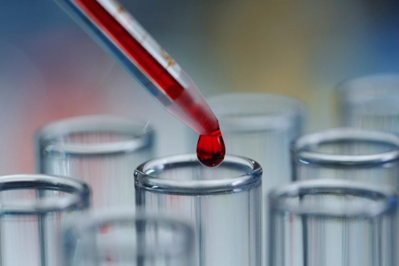 A Routine Blood Test Could Predict Dementia Risk 15 Years in Advance