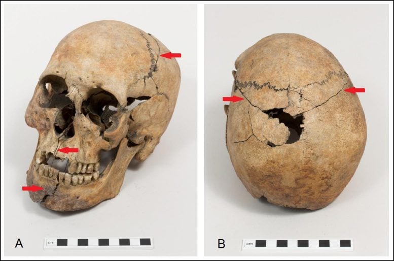 After 150 Years, Scientists May Have Solved the Mystery of Westminster Abbey’s Roman Coffin